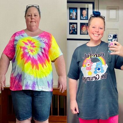 Patient Transformation Stories: Veronica Lost 91 Pounds in 7 Months! - After