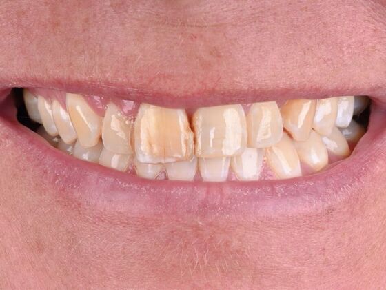 Cosmetic Cases Case 1 - Before