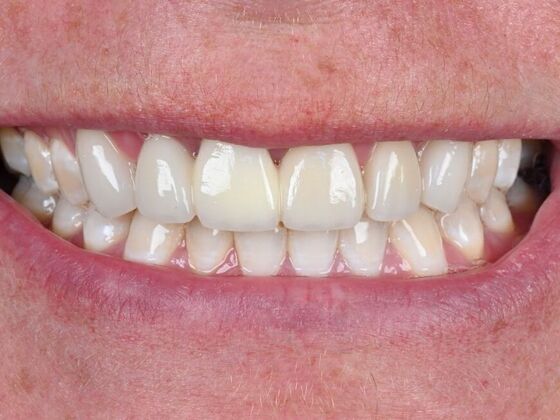 Cosmetic Cases Case 1 - After