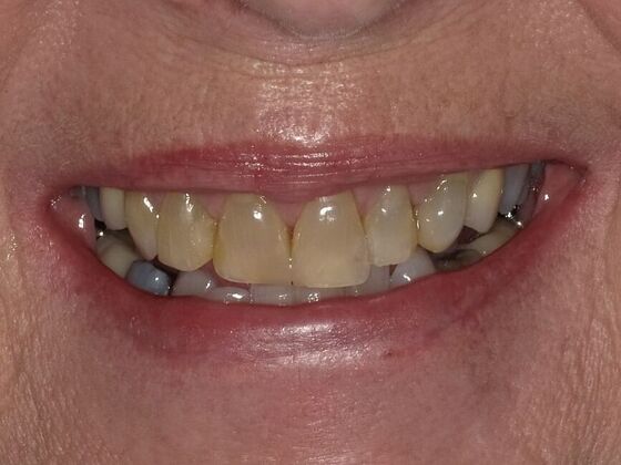 Cosmetic Cases Case 2 - Before