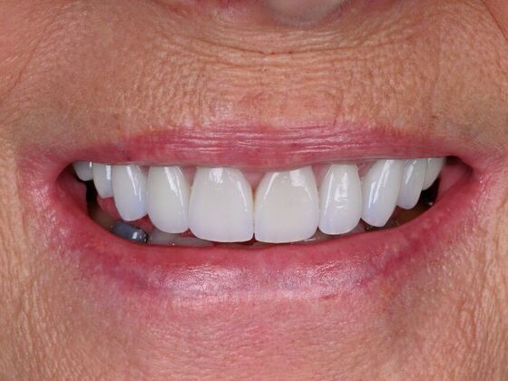 Cosmetic Cases Case 2 - After