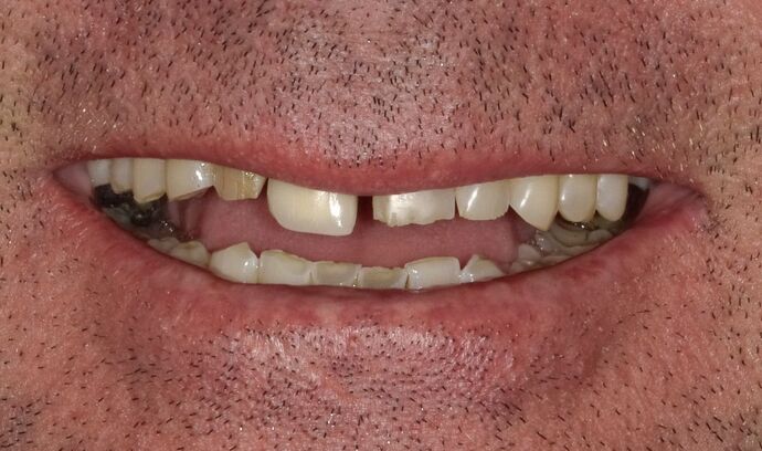 Cosmetic Cases Case 4 - Before