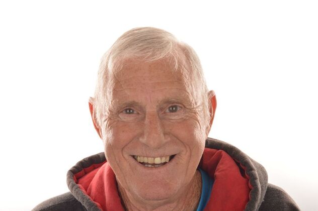 Our Results UPPER ALL ON 4 TEETH IN A DAY - Before