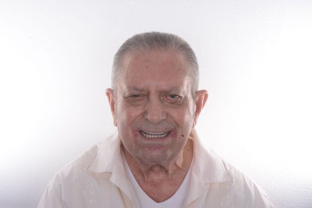 Our Results LOWER ALL ON 4, TEETH IN A DAY - After