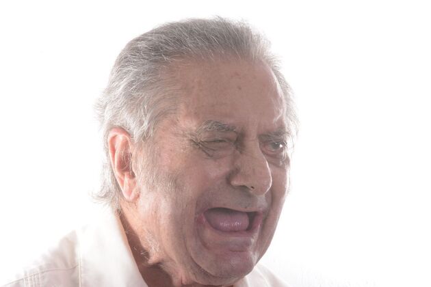 Our Results: LOWER ALL ON 4, TEETH IN A DAY - Before surgery