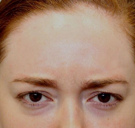 Karen Sticka, PA Case 3 - After