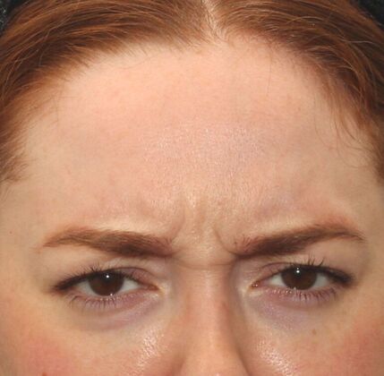 Karen Sticka, PA Case 3 - Before