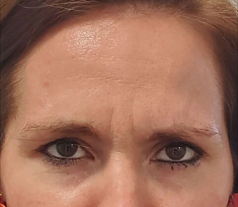 Karen Sticka, PA Case 4 - After