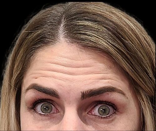 Karen Sticka, PA Case 6 - Before