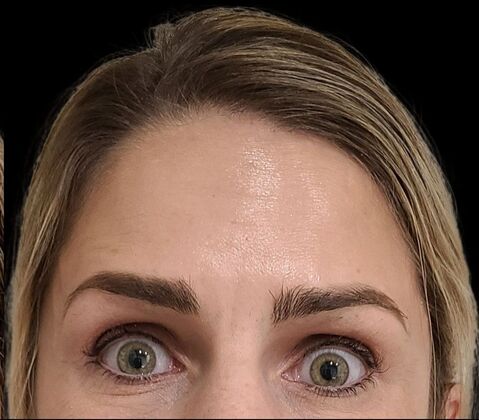 Karen Sticka, PA Case 6 - After