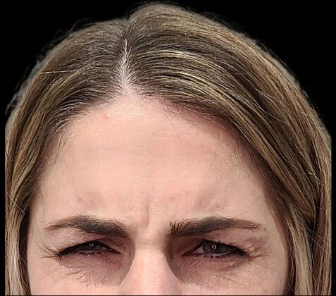 Karen Sticka, PA: Case 6 - Before