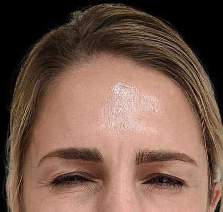 Karen Sticka, PA: Case 6 - After