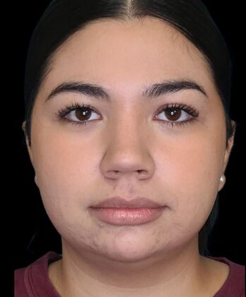 Karen Sticka, PA Case 7 - Before