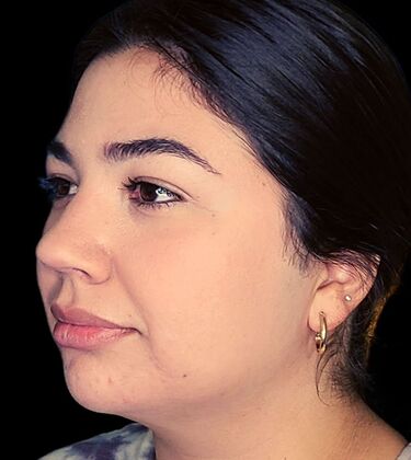 Karen Sticka, PA: Case 7 - After