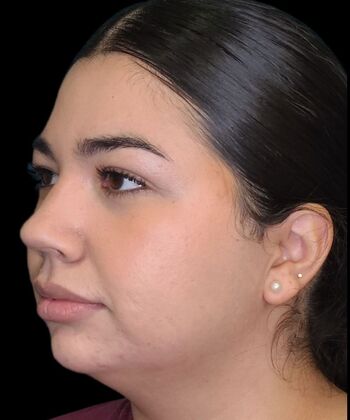 Karen Sticka, PA: Case 7 - Before