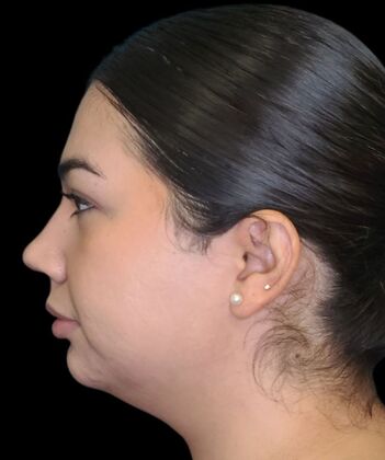 Karen Sticka, PA: Case 7 - Before