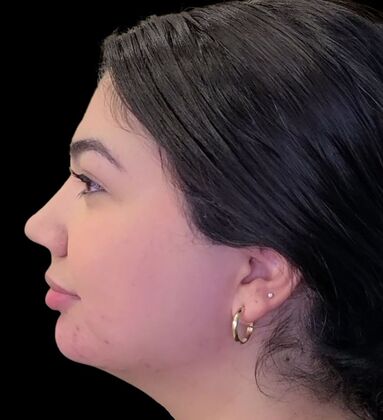 Karen Sticka, PA: Case 7 - After