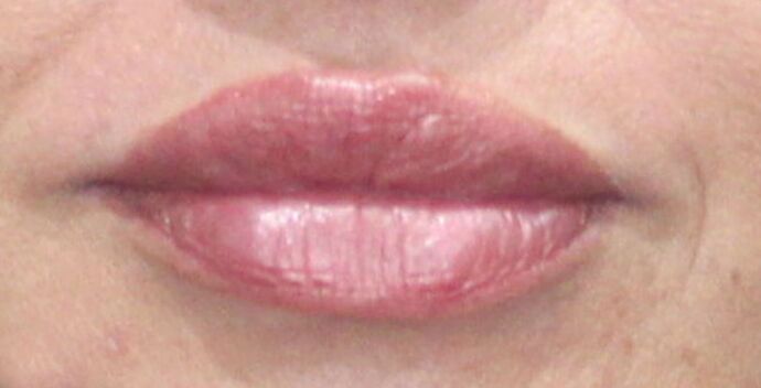 Karen Sticka, PA Case 8 - After