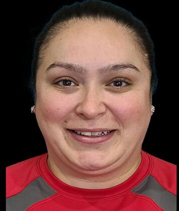 Karen Sticka, PA Case 9 - Before