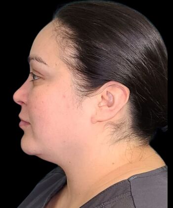 Karen Sticka, PA: Case 9 - After