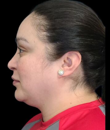 Karen Sticka, PA: Case 9 - Before