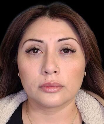 Karen Sticka, PA Case 10 - After