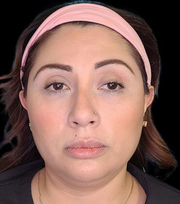 Karen Sticka, PA Case 10 - Before