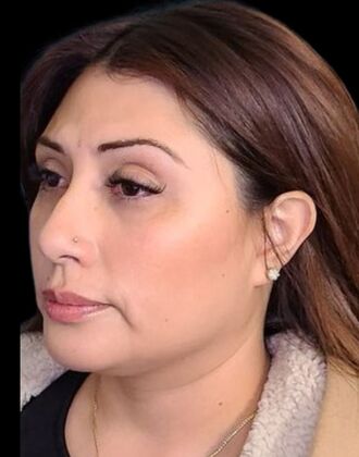 Karen Sticka, PA: Case 10 - After