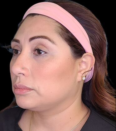 Karen Sticka, PA: Case 10 - Before