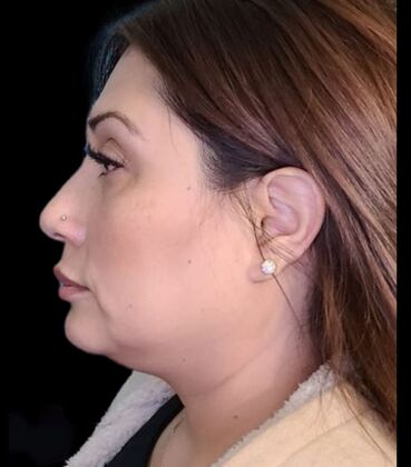 Karen Sticka, PA: Case 10 - After