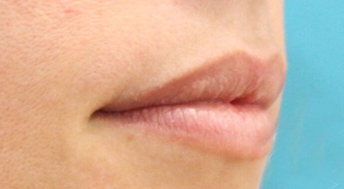 Karen Sticka, PA Case 11 - Before