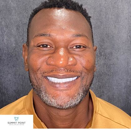 Smile Makeover Cases