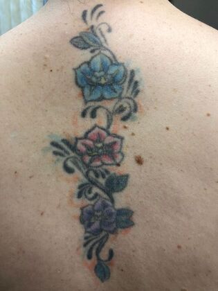 Tattoo Removal : Tattoo Removal 3 - Before