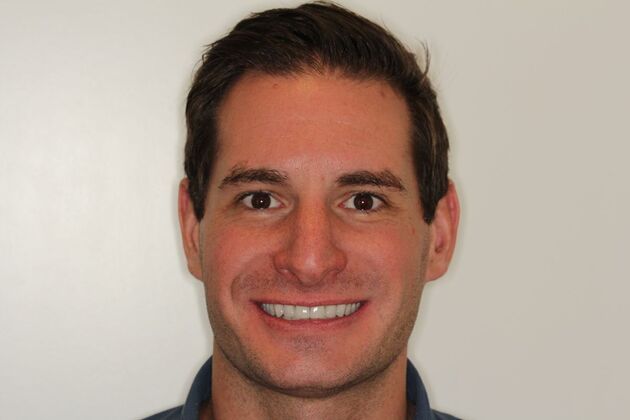 Cosmetic Dentistry: Teeth Veneers - After