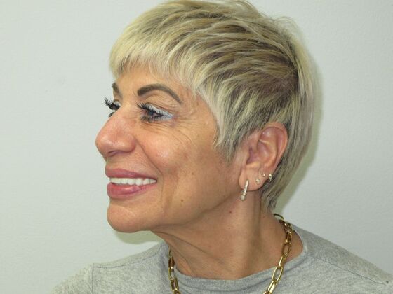 Teeth in a Day: Kathy