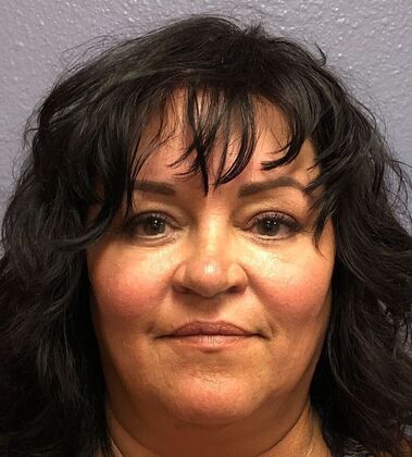 Forehead & Brow Lifts*: Case 1 - After