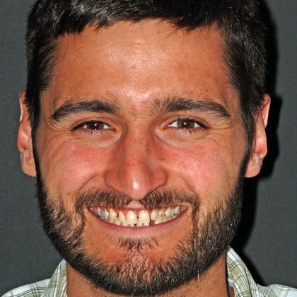 Porcelain Bridges Matt  - Before