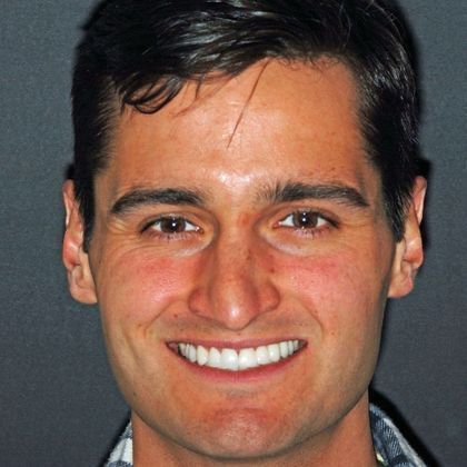 Porcelain Bridges Matt  - After