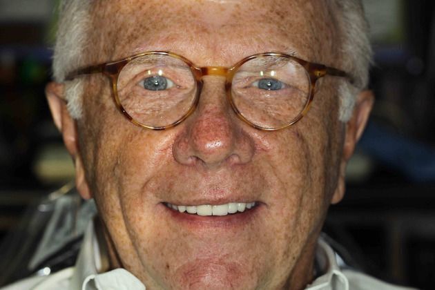 Smile Makeover Case 2 - After