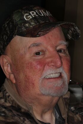 Dentures: Case 18 - After