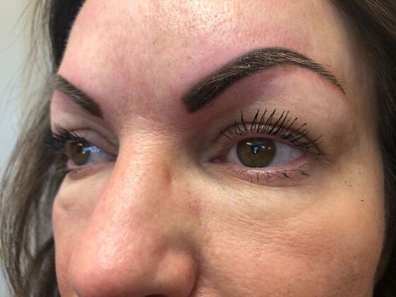 Cosmetic Tattooing: Lash Enhancement - Before