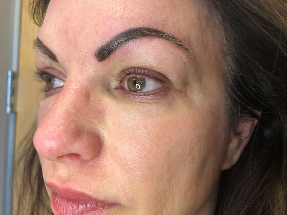 Cosmetic Tattooing: Lash Enhancement - After