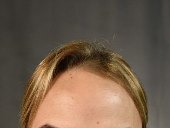 FUT Female: Case 1 - Before