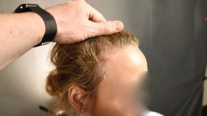 FUT Female: Case 1 - Before