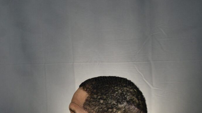 Ethnic Hair Restoration: Case 2 - After