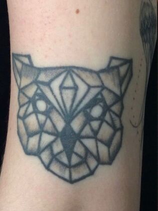 Laser Tattoo Removal Case 12 - Before