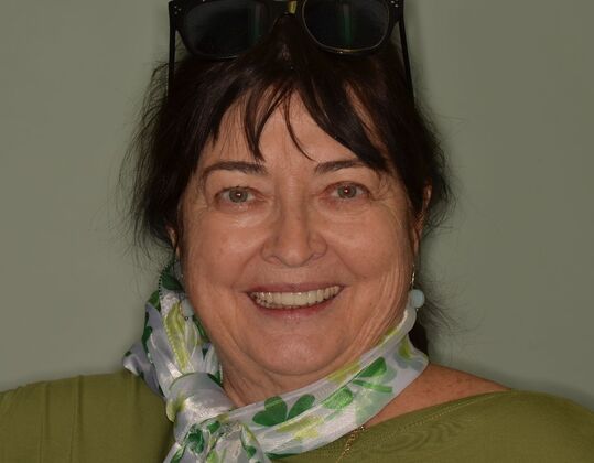 Bridges: Case 10 - After new anterior Bridge