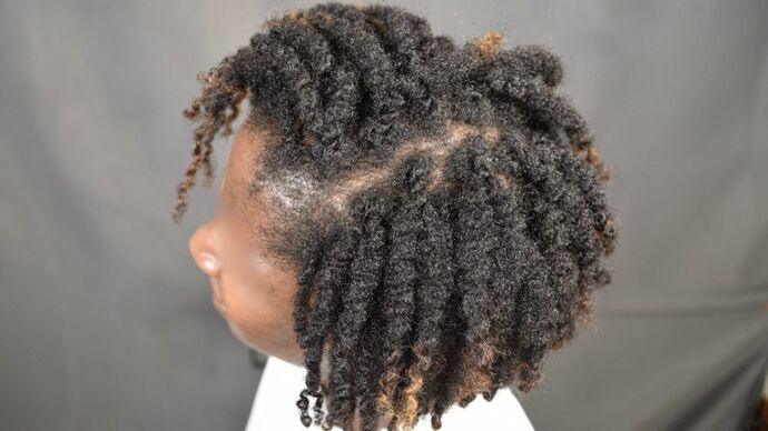 FUT Female: Case 2 - After