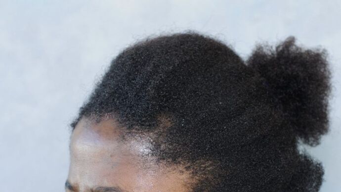 FUT Female: Case 2 - Before