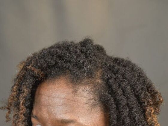 FUT Female: Case 2 - After